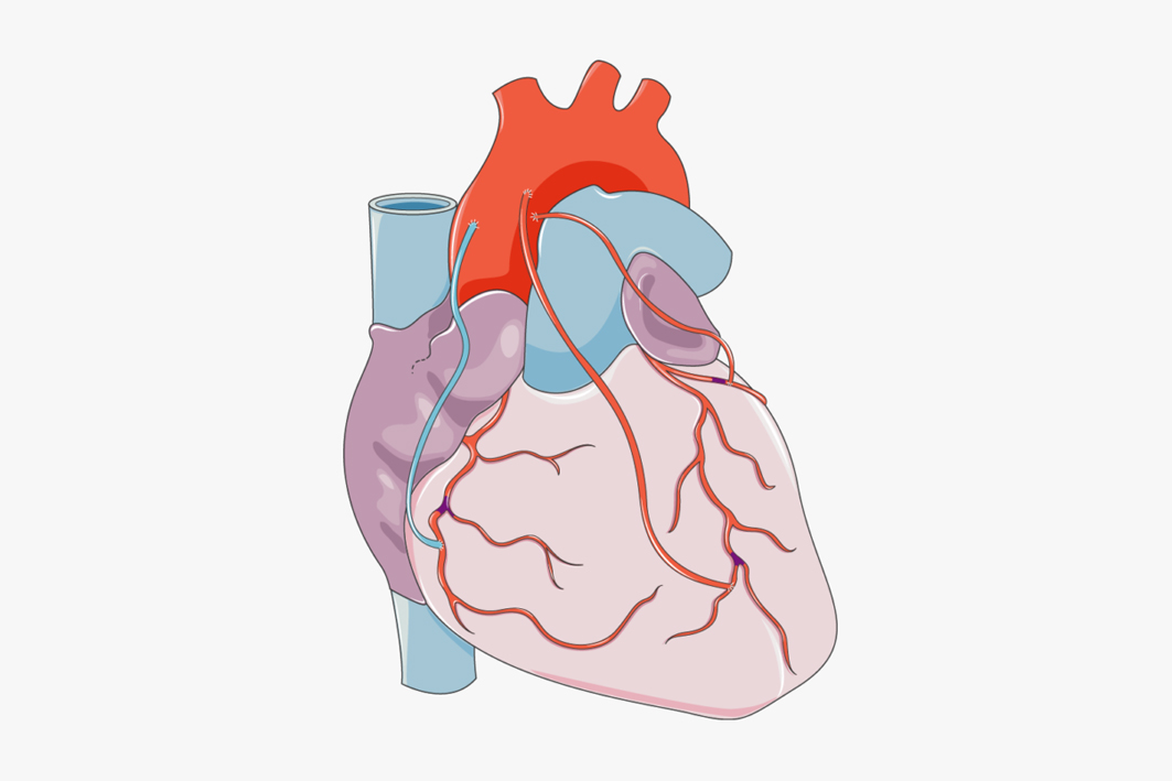 心肌檢測(cè)試劑盒（磁微粒化學(xué)發(fā)光法）